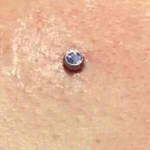 PERFO MICRODERMAL